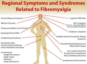 sintomas de la fibromialgia